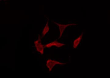 Polyclonal Rabbit anti-Human MAPK8 / JNK1 Antibody (IHC, IF, WB)