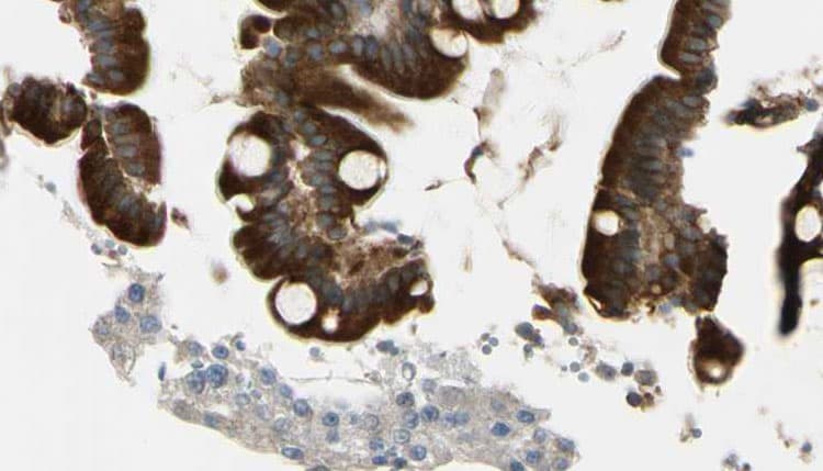 Polyclonal Rabbit anti-Human CRK Antibody (IHC, IF, WB)