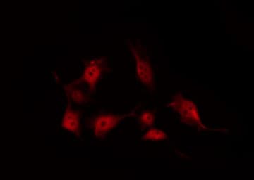 Polyclonal Rabbit anti-Human CRK Antibody (IHC, IF, WB)
