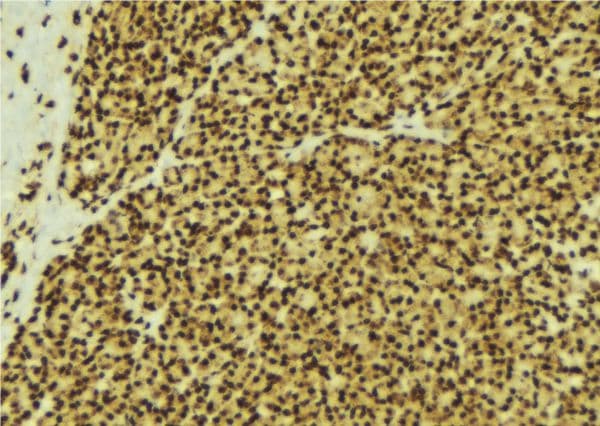 Polyclonal Rabbit anti-Human SMAD3 Antibody (IHC, IF, WB)