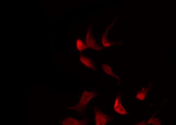 Polyclonal Rabbit anti-Human SMAD3 Antibody (IHC, IF, WB)