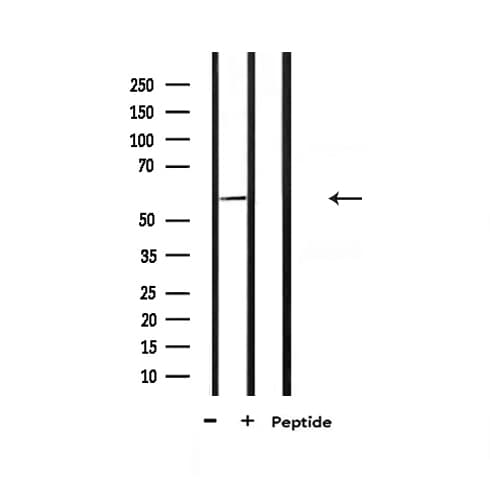 Polyclonal Rabbit anti-Human SMAD3 Antibody (IHC, IF, WB)