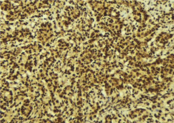 Polyclonal Rabbit anti-Human NFKB2 Antibody (IHC, IF, WB)