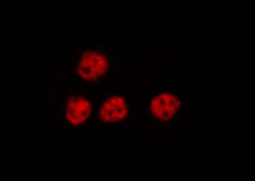 Polyclonal Rabbit anti-Human NFKB2 Antibody (IHC, IF, WB)