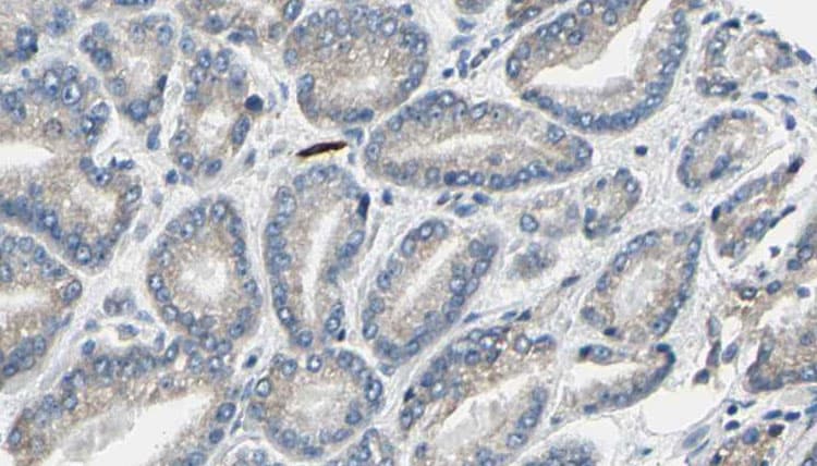 Polyclonal Rabbit anti-Human LIPE / HSL Antibody (IHC, IF, WB)