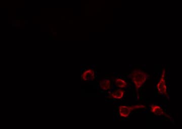 Polyclonal Rabbit anti-Human LIPE / HSL Antibody (IHC, IF, WB)