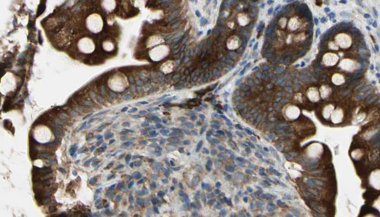 Polyclonal Rabbit anti-Human GRIN1 / NMDAR1 Antibody (IHC, IF, WB)