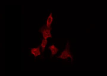 Polyclonal Rabbit anti-Human GRIN1 / NMDAR1 Antibody (IHC, IF, WB)