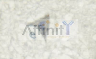 Polyclonal Rabbit anti-Human GRIN1 / NMDAR1 Antibody (IHC, IF, WB)