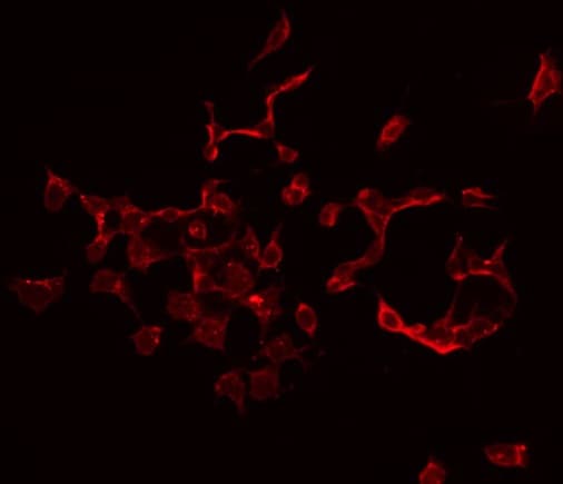 Polyclonal Rabbit anti-Human IL13RA1 / IL13R Alpha 1 Antibody (IHC, IF, WB)