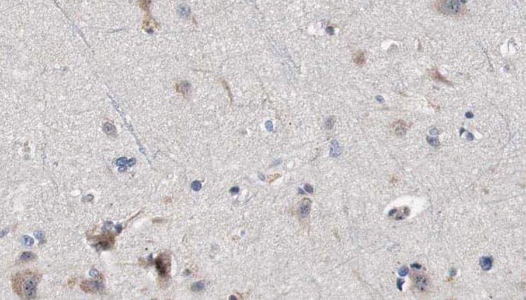 Polyclonal Rabbit anti-Human IL13RA1 / IL13R Alpha 1 Antibody (IHC, IF, WB)