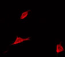Polyclonal Rabbit anti-Human MLC2 / MYL9 Antibody (IF, WB)