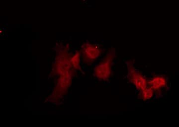 Polyclonal Rabbit anti-Human Peropsin / RRH Antibody (IF, WB)