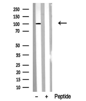 Polyclonal Rabbit anti-Human VR1 / TRPV1 Antibody (WB)