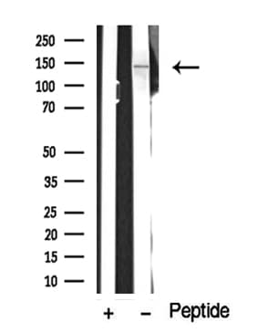 Polyclonal Rabbit anti-Human HIPK1 Antibody (WB)