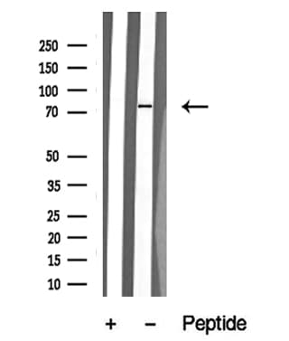 Polyclonal Rabbit anti-Human NUAK1 / ARK5 Antibody (WB)