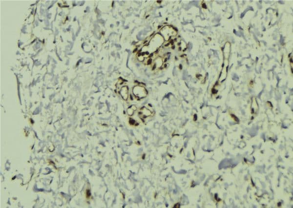 VPRBP Antibody