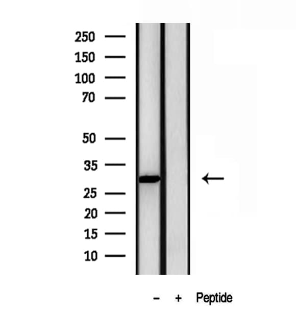 Polyclonal Rabbit anti-Human GALC / Galactocerebrosidase Antibody (IHC, WB)