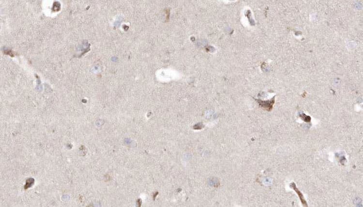 Polyclonal Rabbit anti-Human GALC / Galactocerebrosidase Antibody (IHC, WB)