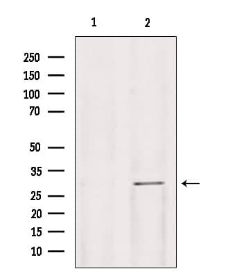 Polyclonal Rabbit anti-Human GALC / Galactocerebrosidase Antibody (IHC, WB)