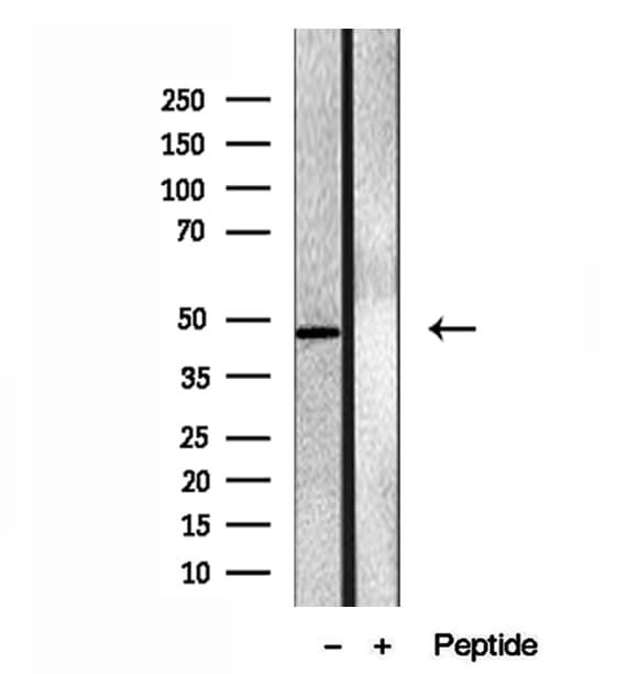 Polyclonal Rabbit anti-Human EIF4A3 Antibody (IHC, IF, WB)