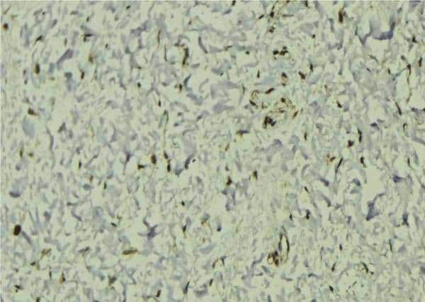 Polyclonal Rabbit anti-Human EIF4A3 Antibody (IHC, IF, WB)