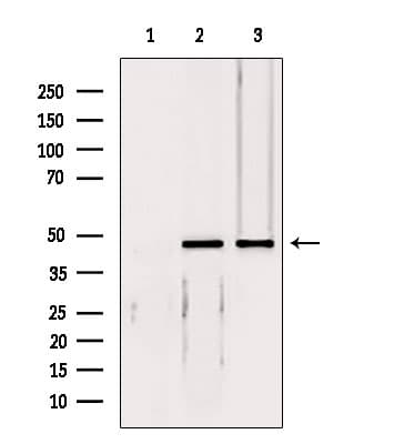 Polyclonal Rabbit anti-Human EIF4A3 Antibody (IHC, IF, WB)