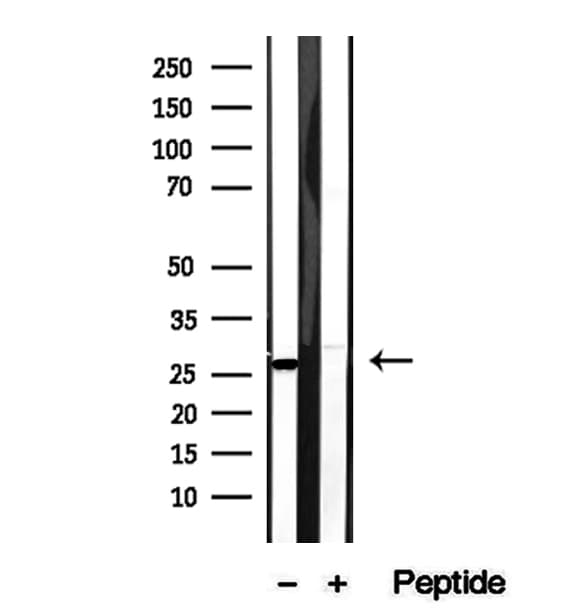 Polyclonal Rabbit anti-Human CHCHD3 Antibody (IHC, IF, WB)