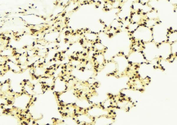 Polyclonal Rabbit anti-Human CHCHD3 Antibody (IHC, IF, WB)