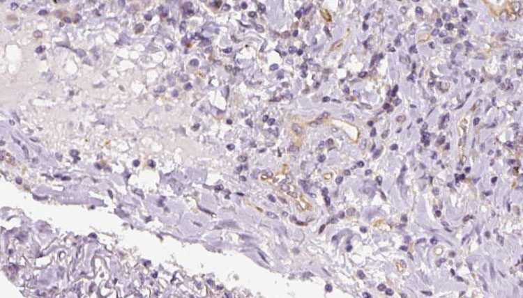 Polyclonal Rabbit anti-Human TIMM17B Antibody (IHC, WB)