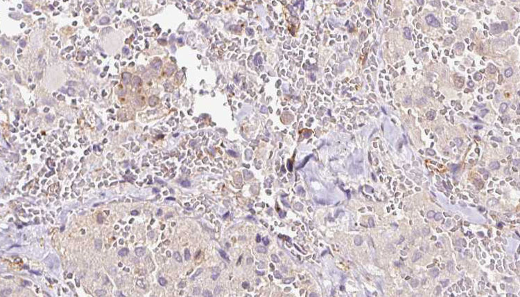 RLBP1 / CRALBP Antibody