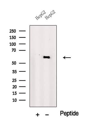 Polyclonal Rabbit anti-Human PRAME Antibody (WB)