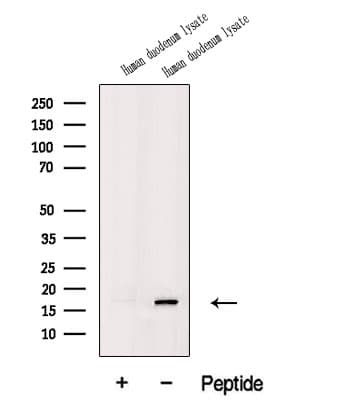 Polyclonal Rabbit anti-Human MIP2 / GRO2 / CXCL2 Antibody (WB)