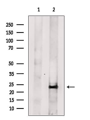Polyclonal Rabbit anti-Human MIP2 / GRO2 / CXCL2 Antibody (WB)