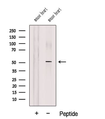 Polyclonal Rabbit anti-Human COQ6 Antibody (WB)