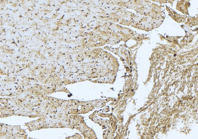 Polyclonal Rabbit anti-Human TNNT3 Antibody (IHC, WB)