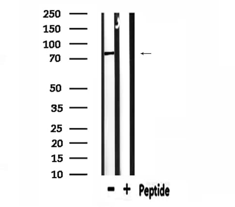 Polyclonal Rabbit anti-Human CD2AP Antibody (IF, WB)