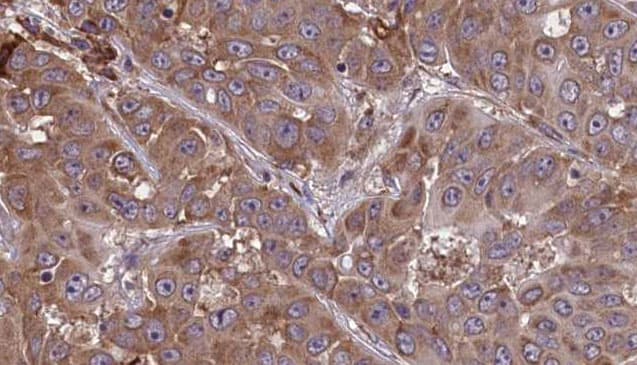 Polyclonal Rabbit anti-Human CD48 Antibody (IHC, IF, WB)