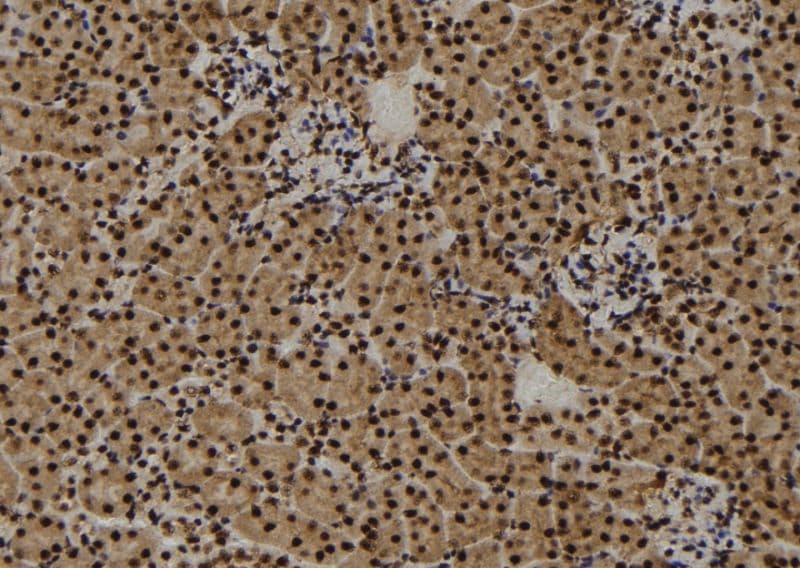 Polyclonal Rabbit anti-Human CENPF / CENP-F Antibody (IHC, WB)