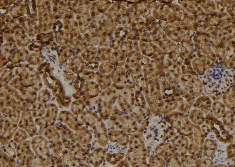 RAD9B Antibody