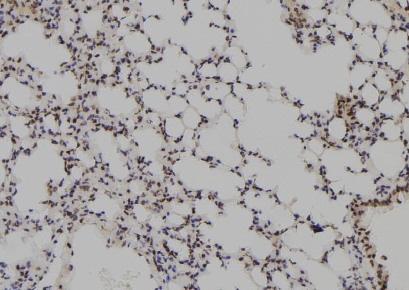 MAGEB5 Antibody
