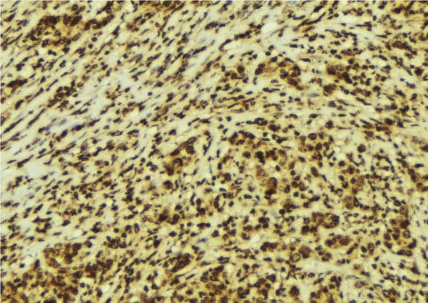 Polyclonal Rabbit anti-Human HMGN2 Antibody (IHC, IF, WB)