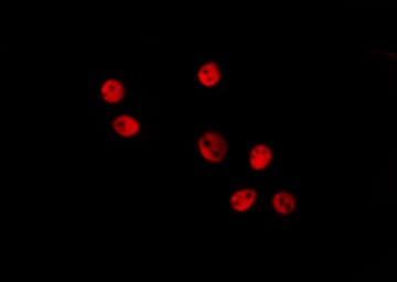 Polyclonal Rabbit anti-Human HMGN2 Antibody (IHC, IF, WB)