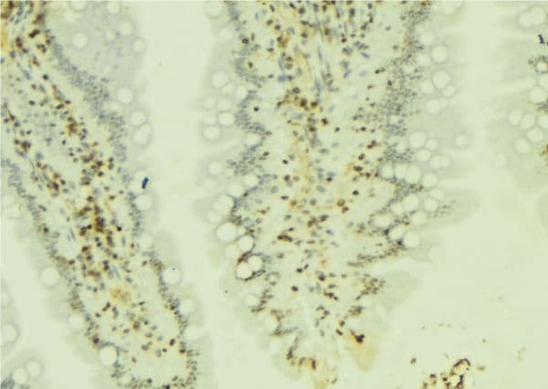 Polyclonal Rabbit anti-Human IRF2 Antibody (IHC, IF, WB)