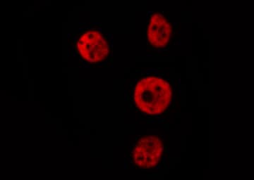 Polyclonal Rabbit anti-Human IRF2 Antibody (IHC, IF, WB)
