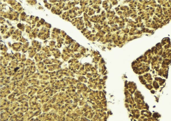 TEAD1 Antibody