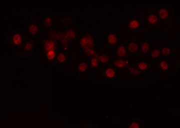 TEAD1 Antibody