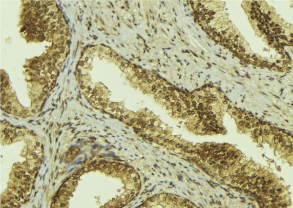 Polyclonal Rabbit anti-Human MED1 / TRAP220 Antibody (IHC, IF, WB)