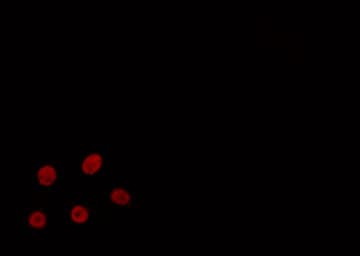 Polyclonal Rabbit anti-Human MED1 / TRAP220 Antibody (IHC, IF, WB)