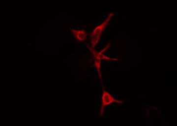 Polyclonal Rabbit anti-Human LYPLA1 Antibody (IF, WB)